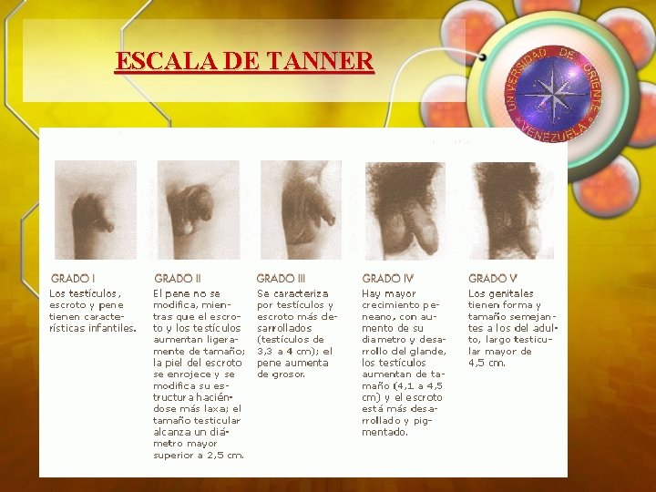 ESCALA DE TANNER 