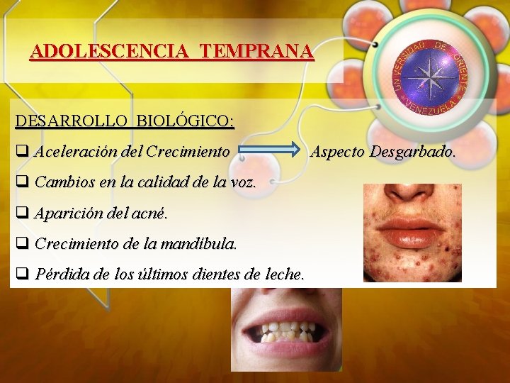 ADOLESCENCIA TEMPRANA DESARROLLO BIOLÓGICO: q Aceleración del Crecimiento q Cambios en la calidad de