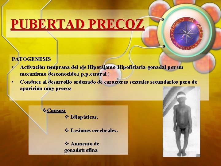 PUBERTAD PRECOZ PATOGENESIS • Activación temprana del eje Hipotálamo-Hipofisiaria-gonadal por un mecanismo desconocido. (