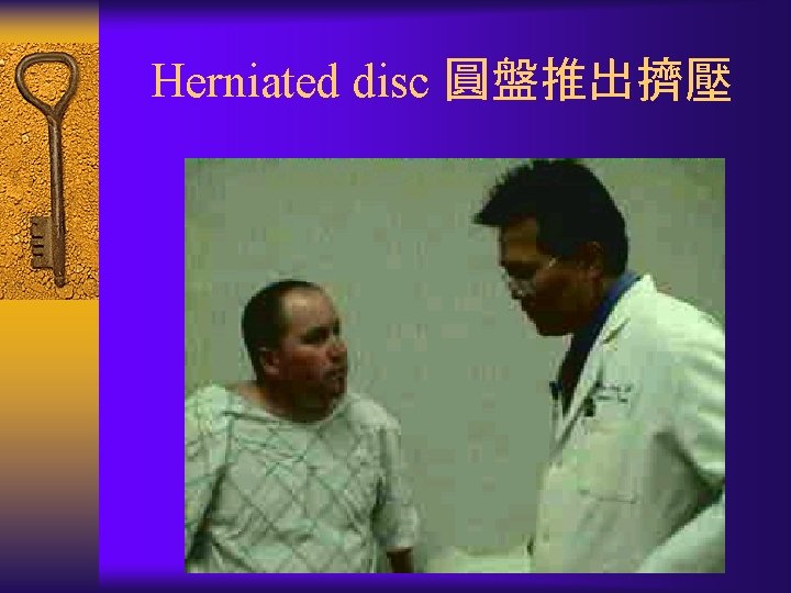 Herniated disc 圓盤推出擠壓 