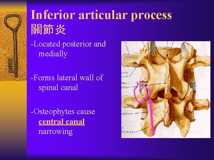 Inferior articular process 關節炎 -Located posterior and medially -Forms lateral wall of spinal canal