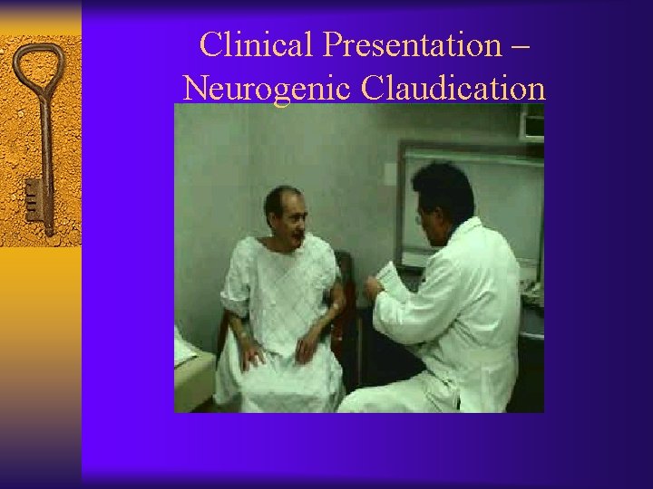 Clinical Presentation – Neurogenic Claudication 