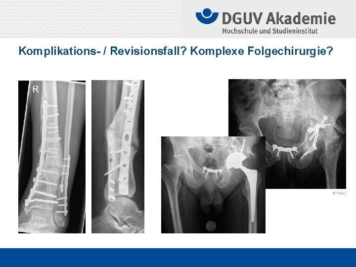 Komplikations- / Revisionsfall? Komplexe Folgechirurgie? © Vetter 