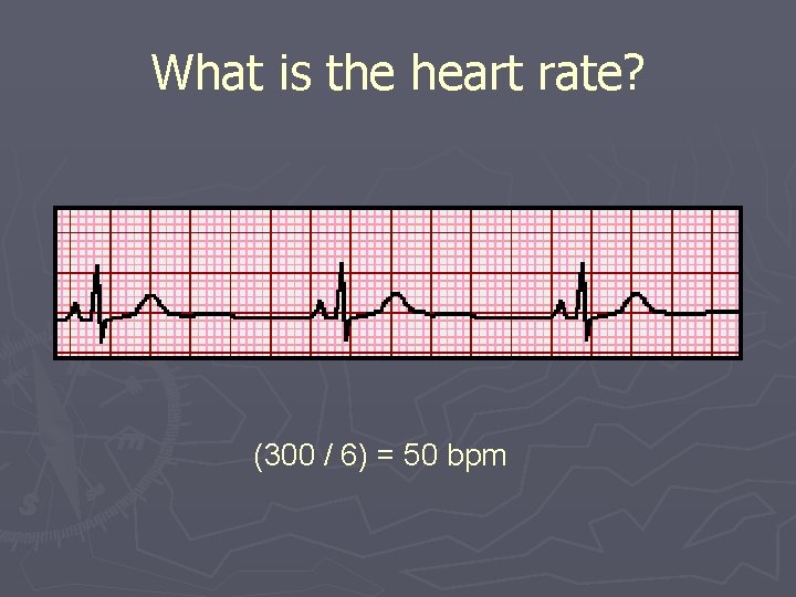 What is the heart rate? (300 / 6) = 50 bpm 