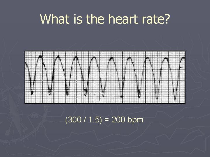 What is the heart rate? (300 / 1. 5) = 200 bpm 