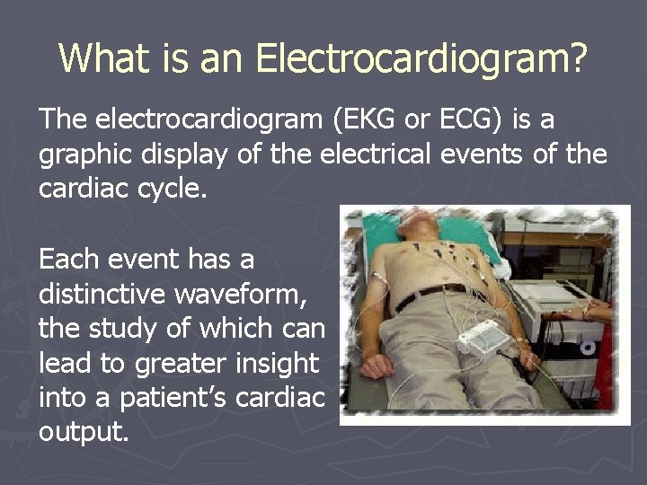 What is an Electrocardiogram? The electrocardiogram (EKG or ECG) is a graphic display of