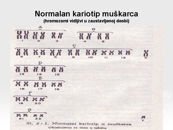 Normalan kariotip muškarca (hromozomi vidljivi u zaustavljenoj deobi) 