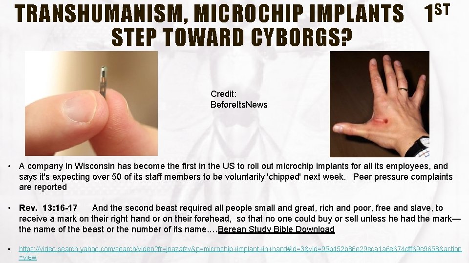 TRANSHUMANISM, MICROCHIP IMPLANTS STEP TOWARD CYBORGS? ST 1 Credit: Before. Its. News • A