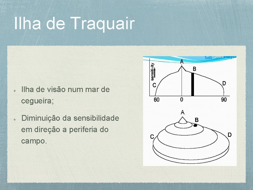 Ilha de Traquair Ilha de visão num mar de cegueira; Diminuição da sensibilidade em