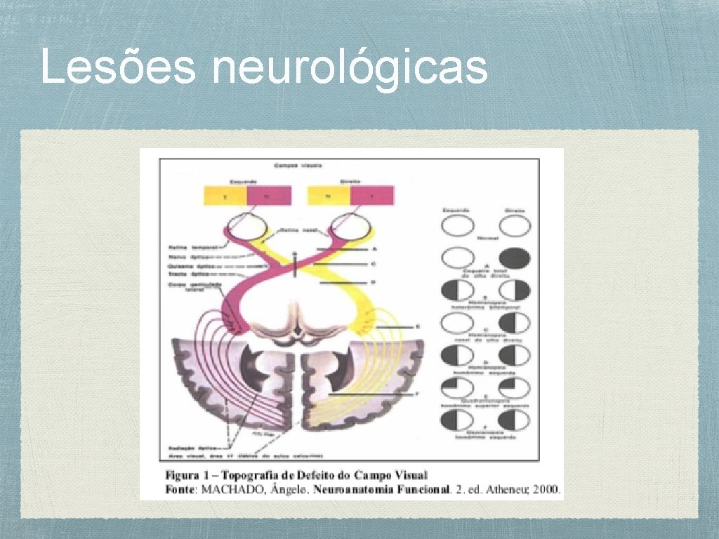 Lesões neurológicas 