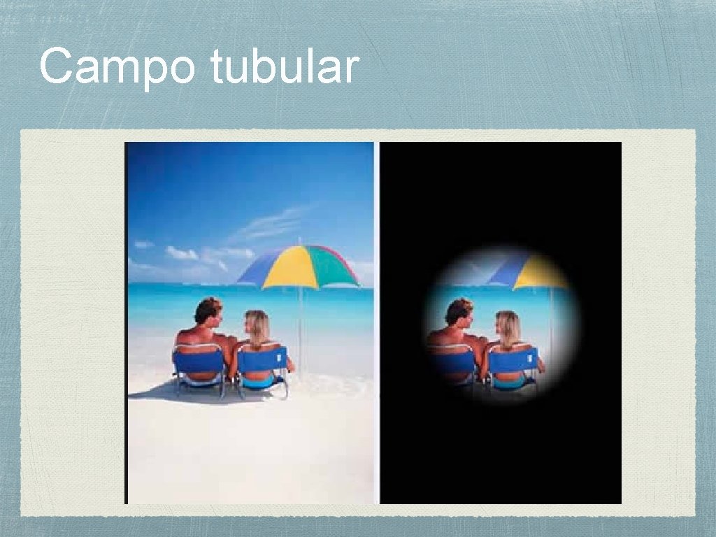 Campo tubular 