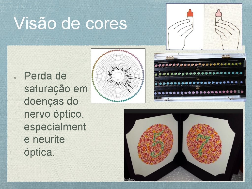 Visão de cores Perda de saturação em doenças do nervo óptico, especialment e neurite