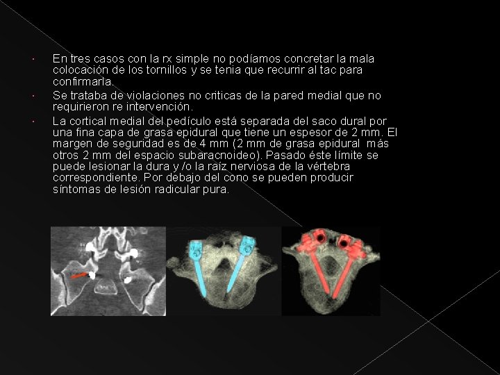  En tres casos con la rx simple no podíamos concretar la mala colocación