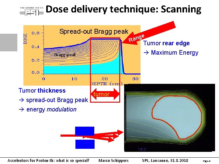 Dose delivery technique: Scanning Spread-out Bragg peak tumour spread-out Bragg peak Tumor rear edge