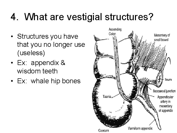 4. What are vestigial structures? • Structures you have that you no longer use