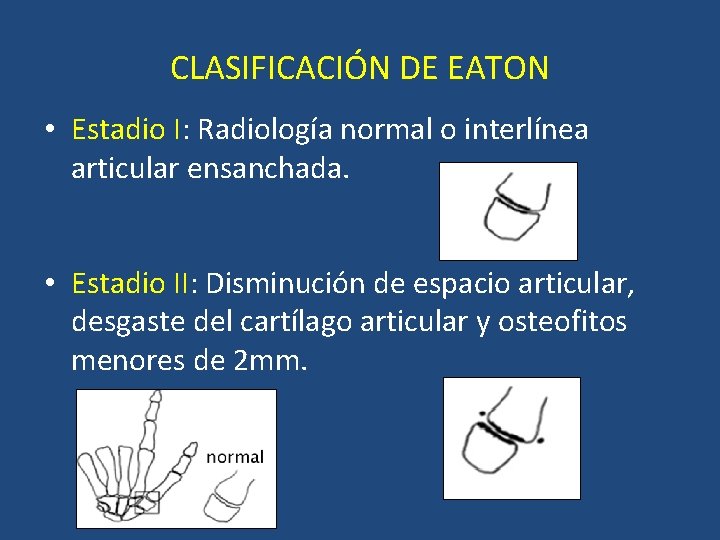 CLASIFICACIÓN DE EATON • Estadio I: Radiología normal o interlínea articular ensanchada. • Estadio CLASIFICACIÓN DE EATON • Estadio I: Radiología normal o interlínea articular ensanchada. • Estadio