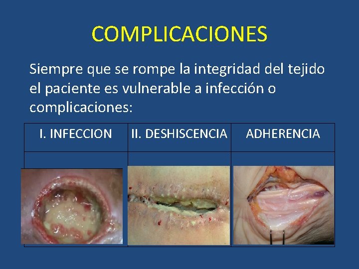 COMPLICACIONES Siempre que se rompe la integridad del tejido el paciente es vulnerable a COMPLICACIONES Siempre que se rompe la integridad del tejido el paciente es vulnerable a
