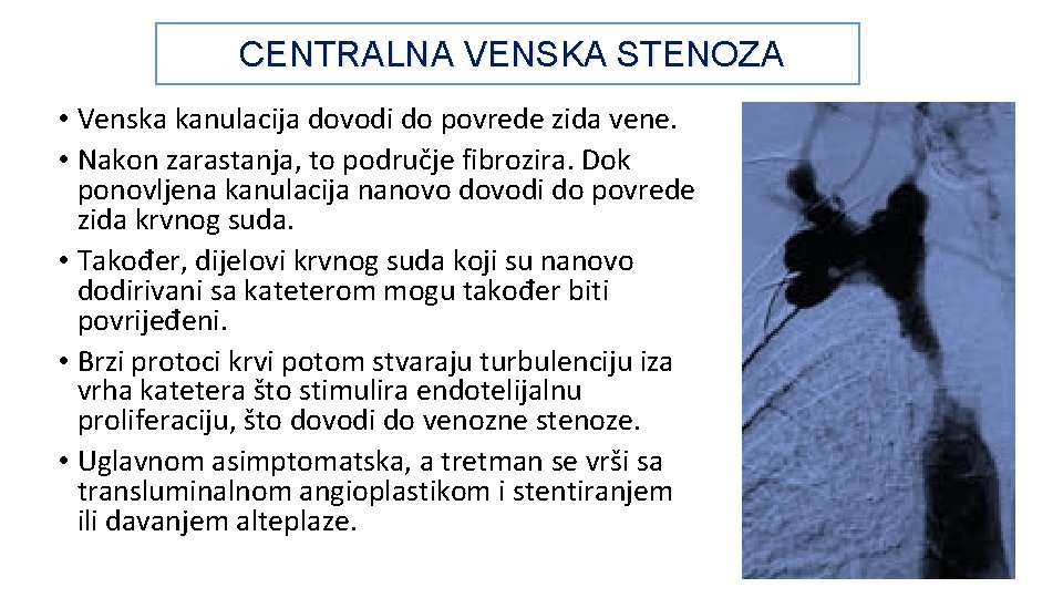 CENTRALNA VENSKA STENOZA • Venska kanulacija dovodi do povrede zida vene. • Nakon zarastanja,