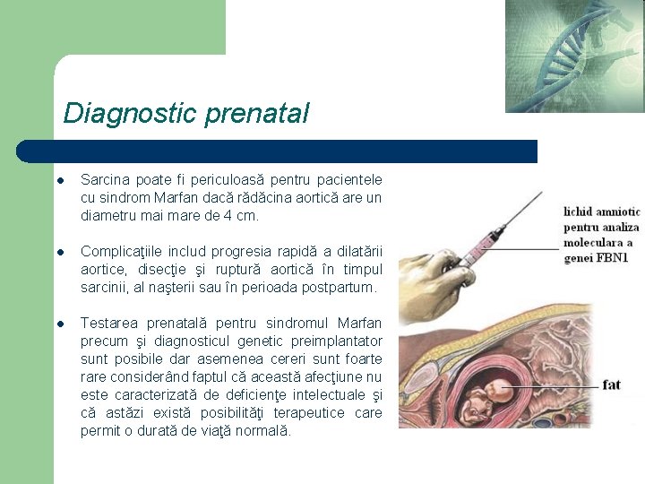 Diagnostic prenatal l Sarcina poate fi periculoasă pentru pacientele cu sindrom Marfan dacă rădăcina