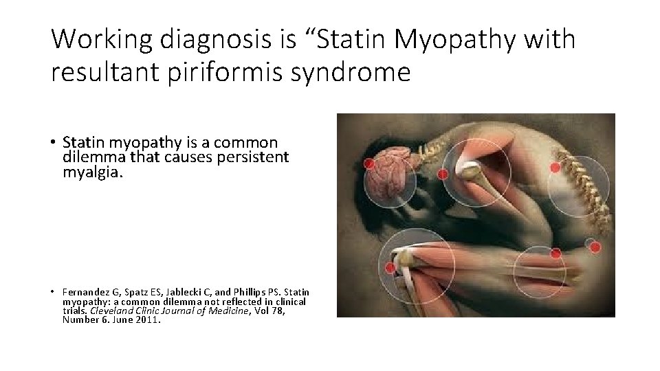 Working diagnosis is “Statin Myopathy with resultant piriformis syndrome • Statin myopathy is a