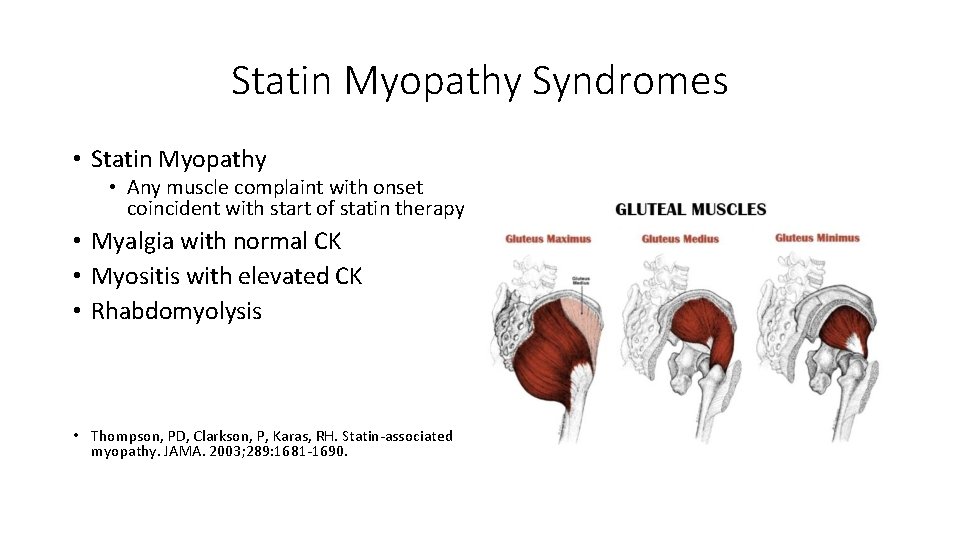 Statin Myopathy Syndromes • Statin Myopathy • Any muscle complaint with onset coincident with