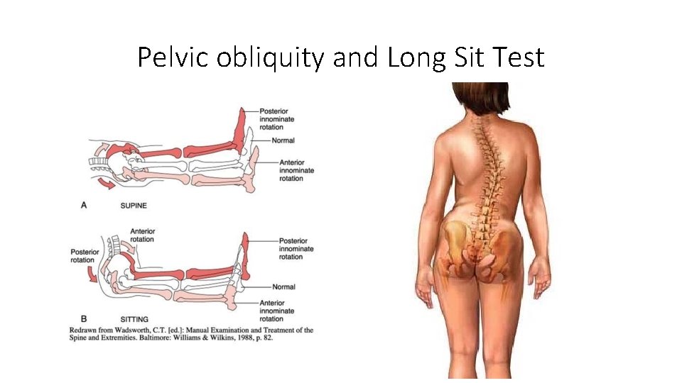 Pelvic obliquity and Long Sit Test 