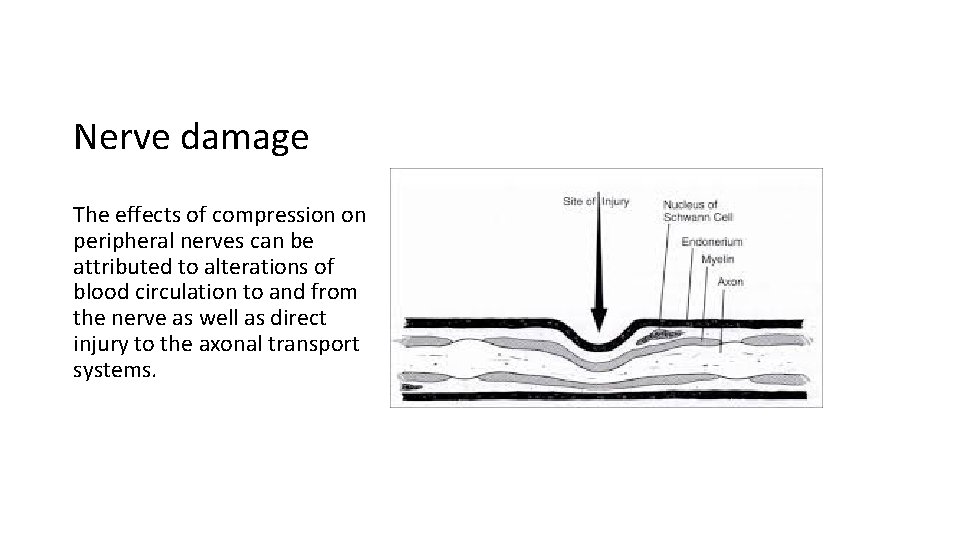 Nerve damage The effects of compression on peripheral nerves can be attributed to alterations