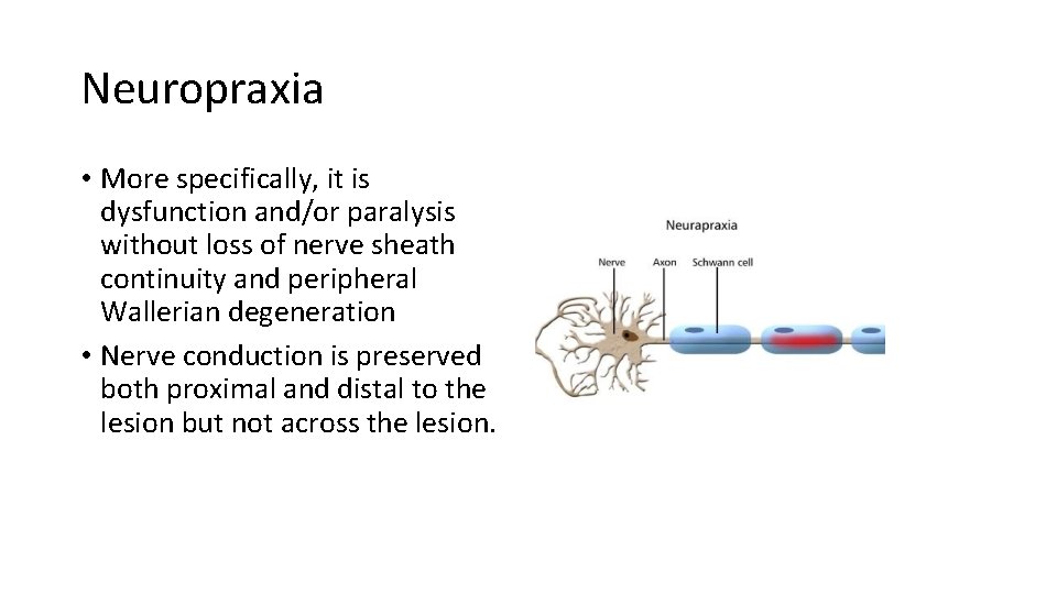 Neuropraxia • More specifically, it is dysfunction and/or paralysis without loss of nerve sheath