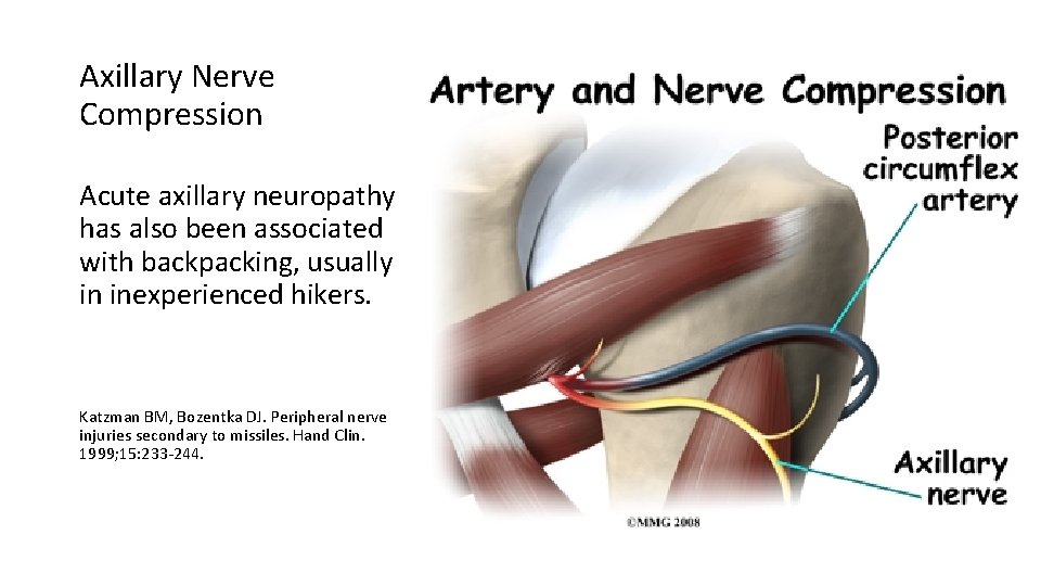 Axillary Nerve Compression Acute axillary neuropathy has also been associated with backpacking, usually in