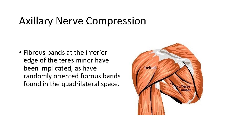 Axillary Nerve Compression • Fibrous bands at the inferior edge of the teres minor
