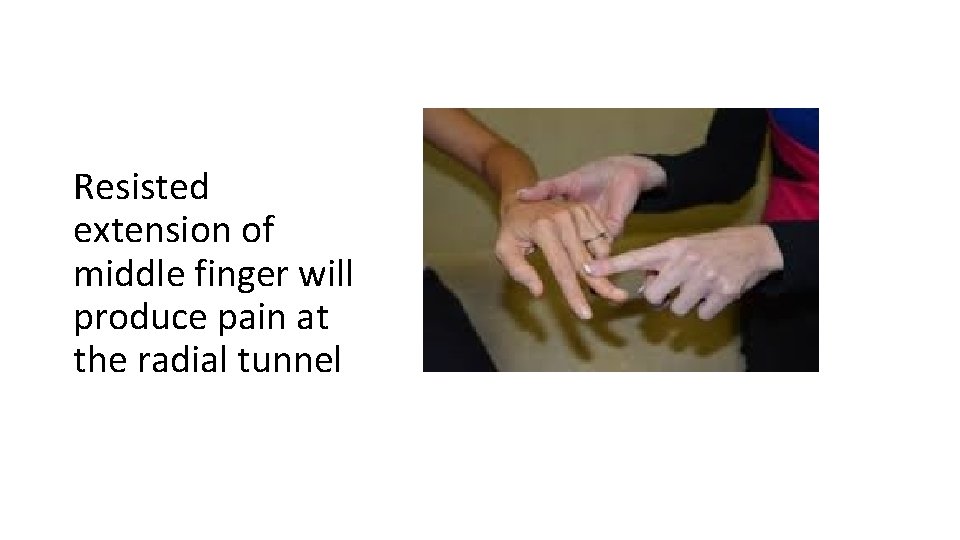 Resisted extension of middle finger will produce pain at the radial tunnel 
