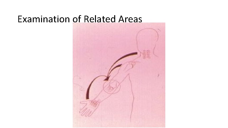 Examination of Related Areas 
