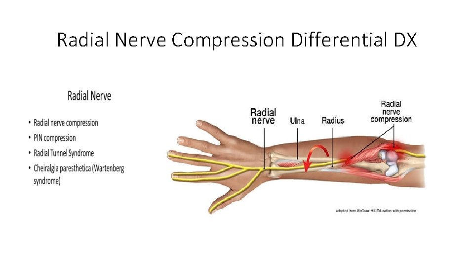 Radial Nerve Compression Differential DX 