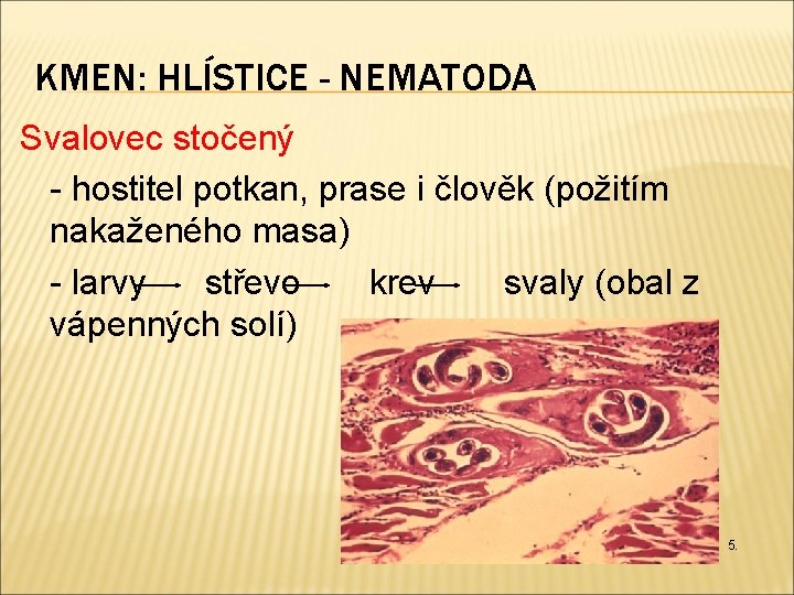 KMEN: HLÍSTICE - NEMATODA Svalovec stočený - hostitel potkan, prase i člověk (požitím nakaženého