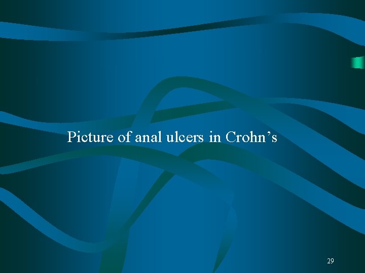 Picture of anal ulcers in Crohn’s 29 Picture of anal ulcers in Crohn’s 29