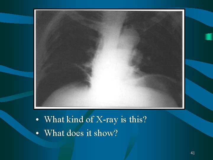 • What kind of X-ray is this? • What does it show? 41 • What kind of X-ray is this? • What does it show? 41