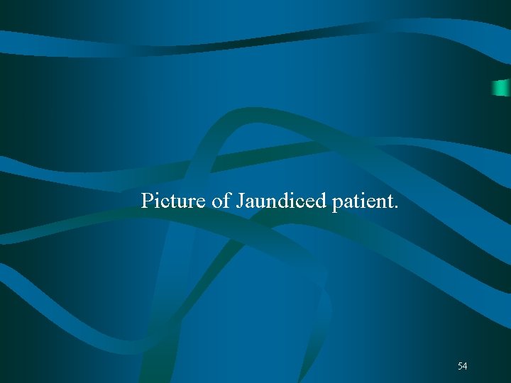 Picture of Jaundiced patient. 54 Picture of Jaundiced patient. 54