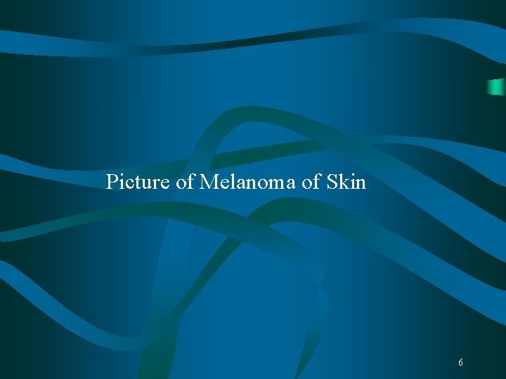 Picture of Melanoma of Skin 6 Picture of Melanoma of Skin 6