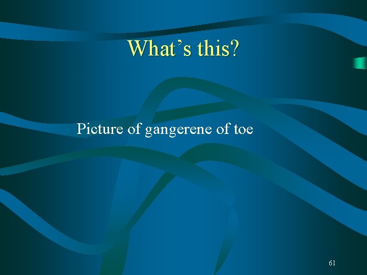 What’s this? Picture of gangerene of toe 61 What’s this? Picture of gangerene of toe 61