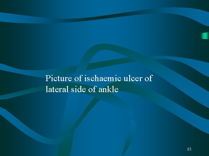 Picture of ischaemic ulcer of lateral side of ankle 63 Picture of ischaemic ulcer of lateral side of ankle 63