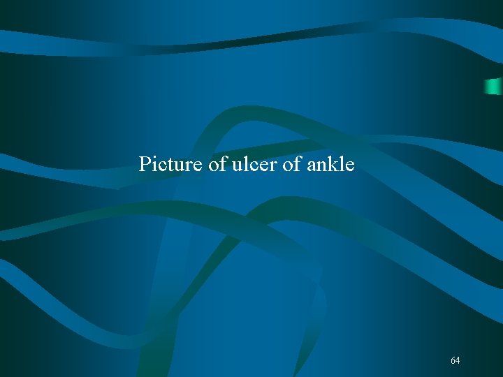 Picture of ulcer of ankle 64 Picture of ulcer of ankle 64