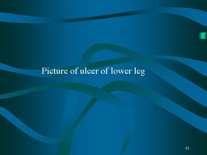 Picture of ulcer of lower leg 65 Picture of ulcer of lower leg 65
