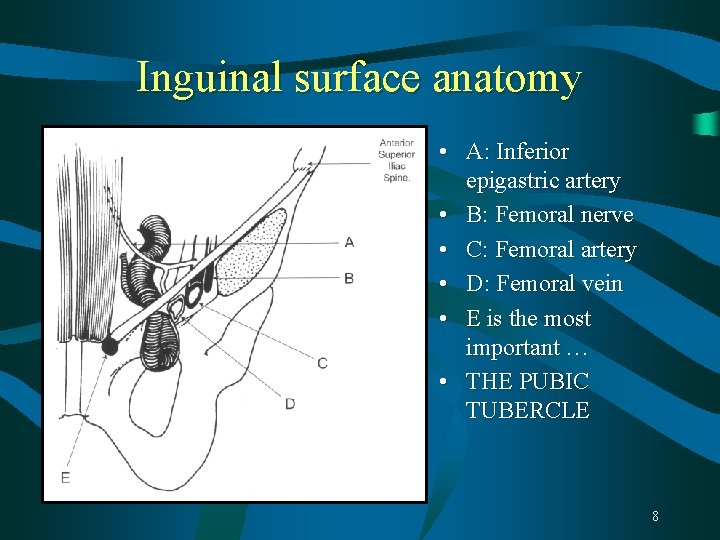 Inguinal surface anatomy • A: Inferior epigastric artery • B: Femoral nerve • C: Inguinal surface anatomy • A: Inferior epigastric artery • B: Femoral nerve • C: