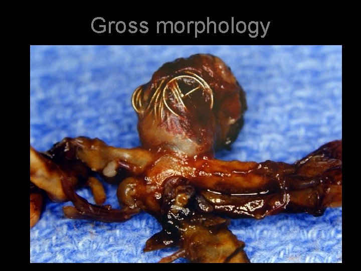 Gross morphology 
