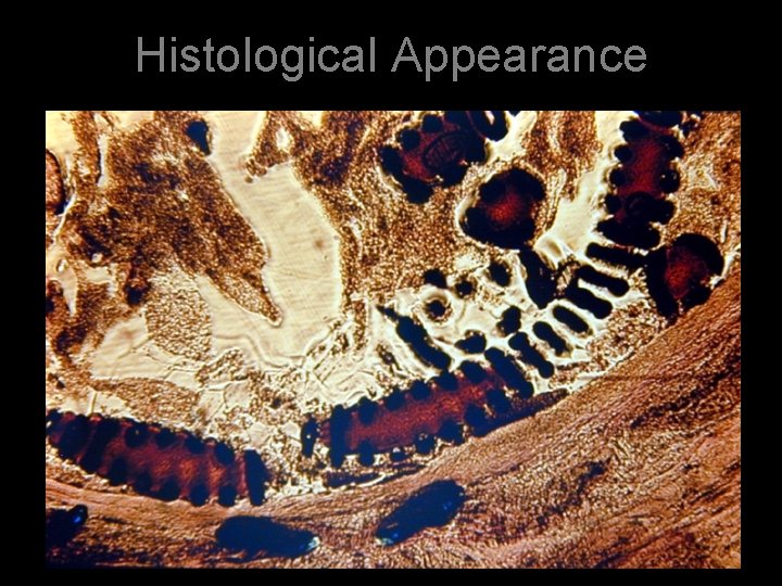 Histological Appearance 