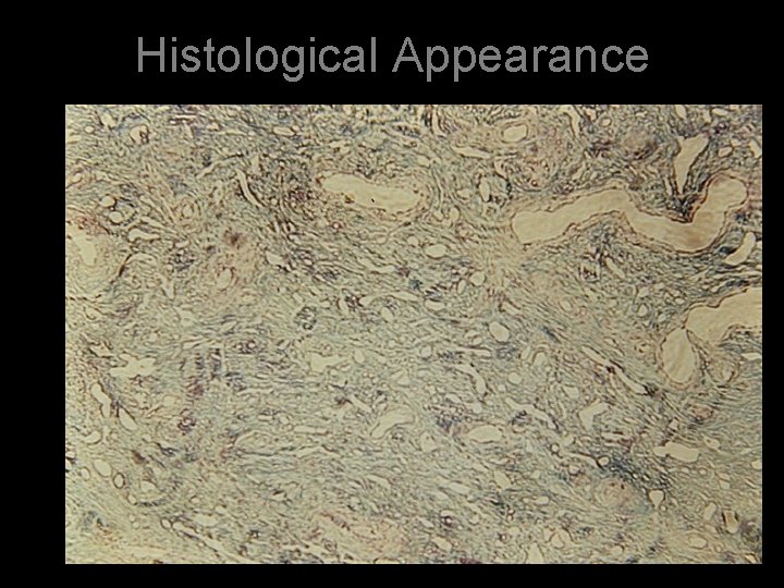 Histological Appearance 