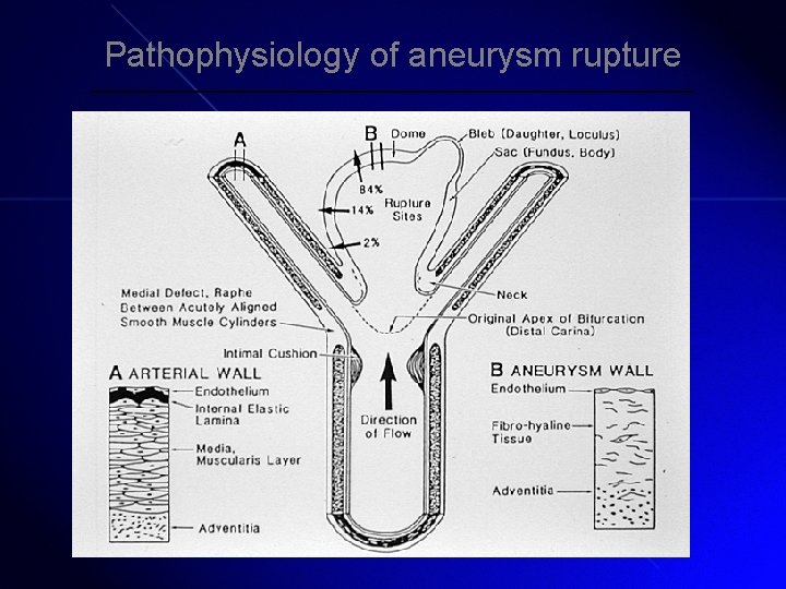 Pathophysiology of aneurysm rupture 