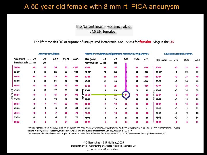 A 50 year old female with 8 mm rt. PICA aneurysm 
