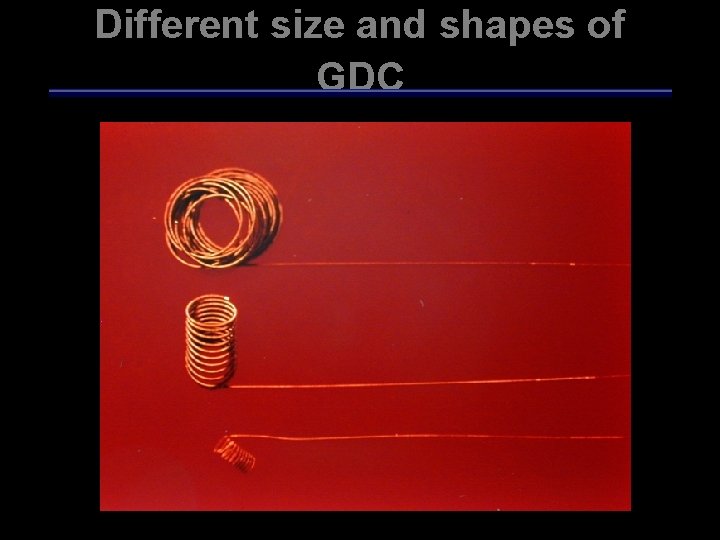 Different size and shapes of GDC 