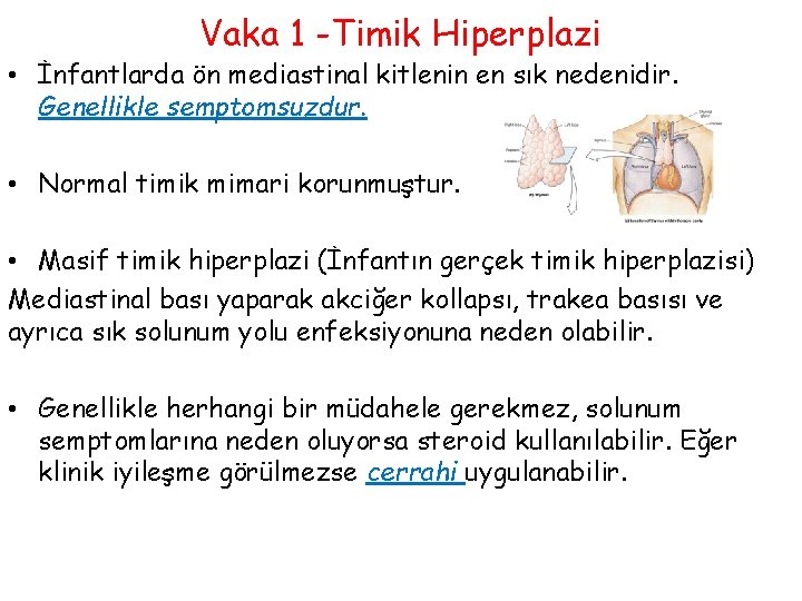Vaka 1 -Timik Hiperplazi • İnfantlarda ön mediastinal kitlenin en sık nedenidir. Genellikle semptomsuzdur.